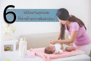 6 วิธีป้องกันลูกน้อยให้ห่างไกลจากผื่นผ้าอ้อม